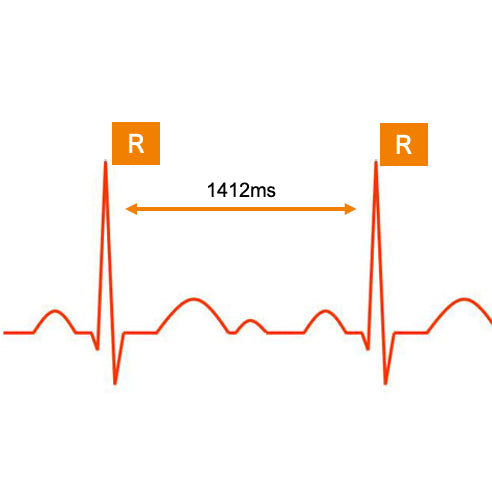 Die Messung der Herzfrequenzvariabilität, die HRV-Messung, misst die Varianz der zeitlichen Abstände zwischen den R-Zacken